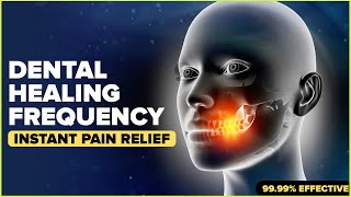 ⭐ALL IN 1 DENTAL HEALING FREQUENCY⭐Instant Relief From Teeth Ache  Pain Teeth amp Gums Treatment [upl. by Fakieh]