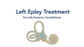 Left Posterior Canal BPPV  BalanceMD  wwwBalanceMDnet [upl. by Enneyehc295]