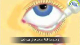 الطريقة الصحيحة لإستخدام قطرات ومراهم العين [upl. by Lehcem]