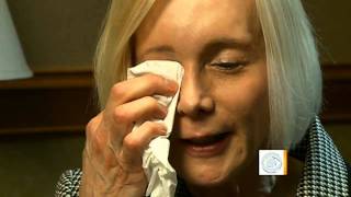 Eyelid surgery leaves woman unable to blink [upl. by Alihs680]