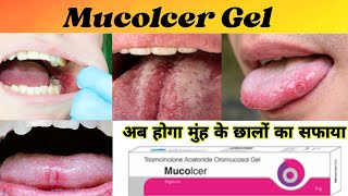 Mucolcer Gel  Mucolcer Gel uses  Mucolcer in hindi [upl. by Kiraa56]