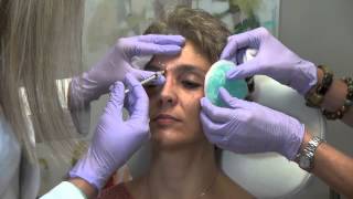 What is Botox and How Does it Work [upl. by Pinelli869]