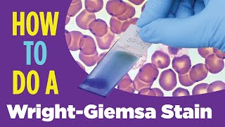 How to do a hematology stain WrightGiemsa stain Laboratory Tutorial Procedure [upl. by Torrie159]