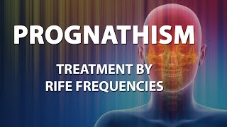 Prognathism  RIFE Frequencies Treatment  Energy amp Quantum Medicine with Bioresonance [upl. by Izzy116]