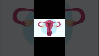 Ovarian cyst Causes TreatmentAnde dani ma pani k theli ilaj UrduHindi ovariancysts ytshorts [upl. by Ahtekahs]