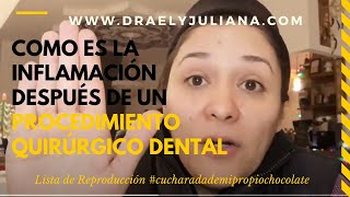 CIRUGÍA DENTAL👅 COMO SE BAJA LA INFLAMACIÓN cucharadademipropiochocolate [upl. by Idmann383]