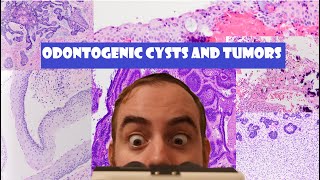 The ULTIMATE Odontogenic Cyst and Tumor Review Video [upl. by Lemart89]