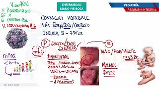 Pediatría  Exantemas Enfermedad M P B [upl. by Alfeus281]