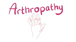 Arthropathy  Joint Pathology Classification [upl. by Asert207]