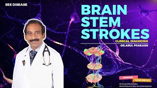 BRAIN STEM STROKES  Diagnosis and Localization  NEUROLOGY [upl. by Aihsyla]