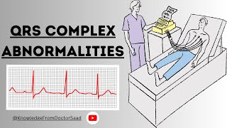 Understanding QRS Complex Abnormalities Causes Symptoms and Diagnosis  ECG cardiachealth 2023 [upl. by Soule]