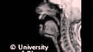 MRI voiced alveolar lateralapproximant [upl. by Sivartal]