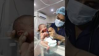 Nasogastric NG Tube Insertion in NeonatalNewborn😱 Orogastris OGTube Feeding tube baby viral [upl. by Yauqaj]