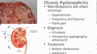 Pathophysiology Renal 3 UTI Acute and Chronic [upl. by Adnawot439]