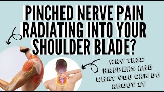 Best Exercise for Neck Pain Pinched Nerve and Shoulder Blade Pain [upl. by Tut]