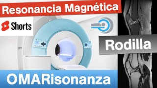 Resonancia Magnética🧲 de rodilla 4￼ resonanciamagnética rodilla salud shorts radiología [upl. by Kali]