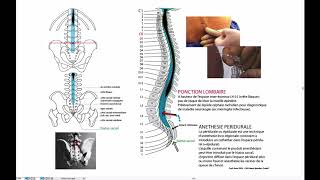 Ponction lombaire [upl. by Previdi]