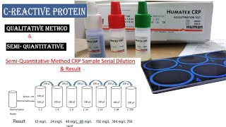 CRP Test Procedure ll How to Do Qualitative amp Semi Quantitative Test Procedure [upl. by Bunder714]