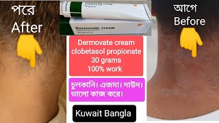 Dermovate Cream  Clobetasol Propionate  100 works চুলকানি। এজমা। দাউদ। ভালো কাজ করে kuwaitbangla [upl. by Esserac]