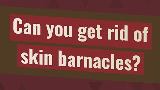 Can you get rid of skin barnacles [upl. by Odlavso]