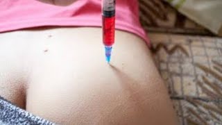 How to Give an IM Intramuscular injection in the Buttocks  Dorsogluteal hip Technique 👨‍⚕ [upl. by Suivatna]