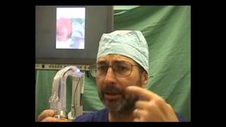 Awake endotracheal intubation with Pentax AWS videolaryngoscope [upl. by Nilsoj]