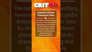 Arterial Catheter Placement Sites [upl. by Sirois]