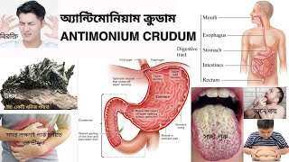 07 Antimonium Crudum l এন্টিমোনিয়াম ক্রুডাম l Materia Medica l Learn Antimonium Crudum easily [upl. by Lraep]