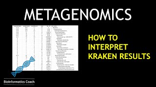 Metagenomics Data Analysis Tutorial  How to Interpret a KRAKEN results [upl. by Oler]