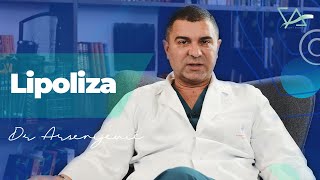 Sve što treba da znate o lipolizi  Dr Vladimir Arsenijević [upl. by Ahsinik]