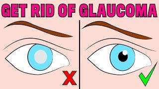 How to reverse chronic glaucoma naturally in 4 minutes a day [upl. by Gulick413]