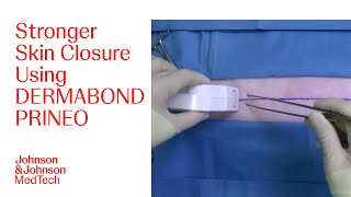 StepbyStep Guide for Effective Application of DERMABOND PRINEO Skin Closure System  JampJ MedTech [upl. by Lleon615]