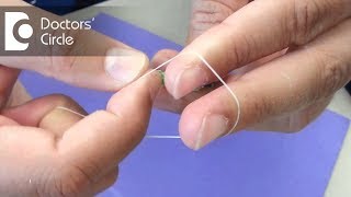 What is Rubber Band Ligation amp how is it done  Dr Nagaraj B Puttaswamy [upl. by Jona]