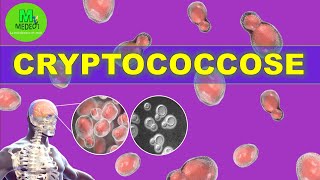 CRYPTOCOCCOSE  cours de mycologie médicale [upl. by Omlesna]