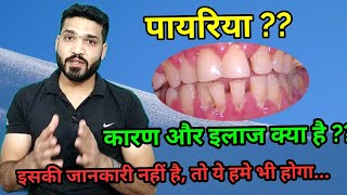 पायरिया क्या है  इसके कारण लक्षण और इलाज । pyriya  periodontitis causes symptoms amp treatment [upl. by Akamahs]