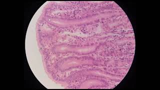 5 Stomach Histology [upl. by Salita]