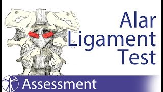 Alar Ligament Stress Test  Upper Cervical Spine Instability [upl. by Kial]