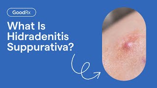 Hidradenitis Suppurativa Explained Symptoms Causes and Complications  GoodRx [upl. by Latreece]