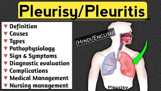 PleurisyPleuritis lecture in Hindi and English medical nursingcriteria pleuritis paramedical [upl. by Keynes]