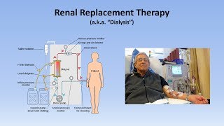 Acute Kidney Injury Part 33  Treatment and Complications [upl. by Bergin]