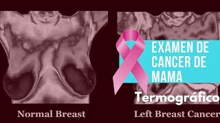 Examen de cancer de mama  Termografia mi experiencia Susy Rosado [upl. by Lindsey]