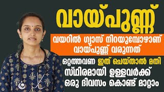 വായ്പുണ്ണ് പൂർണമായും മാറ്റാൻ തൈര് കൊണ്ട് ഇങ്ങനെ ചെയ്യൂ  vaypunn maran [upl. by Llenahs505]