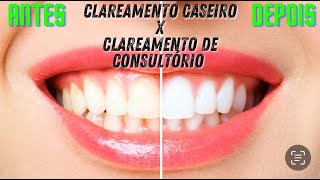 QUAL O MELHOR CLAREAMENTO DENTÁRIO [upl. by Imojean]