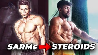 He Switched From SARMs To Steroids And This Is What Happened [upl. by Ghassan118]