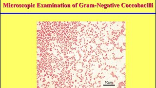 سكشن عملى Gramnegative coccobacilli [upl. by Yllaw]