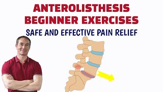 Lumbar Anterolisthesis Exercises [upl. by Brunell]