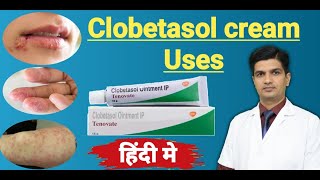 Clobetasol Propionate cream uses  Tenovate cream Uses in hindi [upl. by Aticilef]