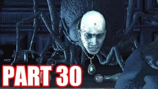 PATCHES  BloodBorne Lets Play  Part 30 [upl. by Jeggar]