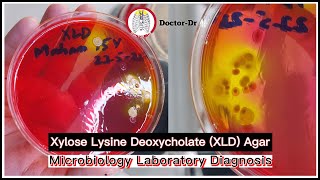 Xylose Lysine Deoxycholate XLD Agar Principle Uses Composition Preparation amp Colony Morphology [upl. by Notlek]