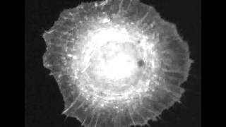 Adaptive rheology and ordering of cell cytoskeleton govern matrix rigidity sensing [upl. by Illak]